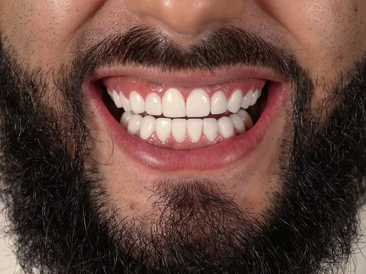 Real patient smile · Cosmetic Dentist · Smile Dental Center Miami 3