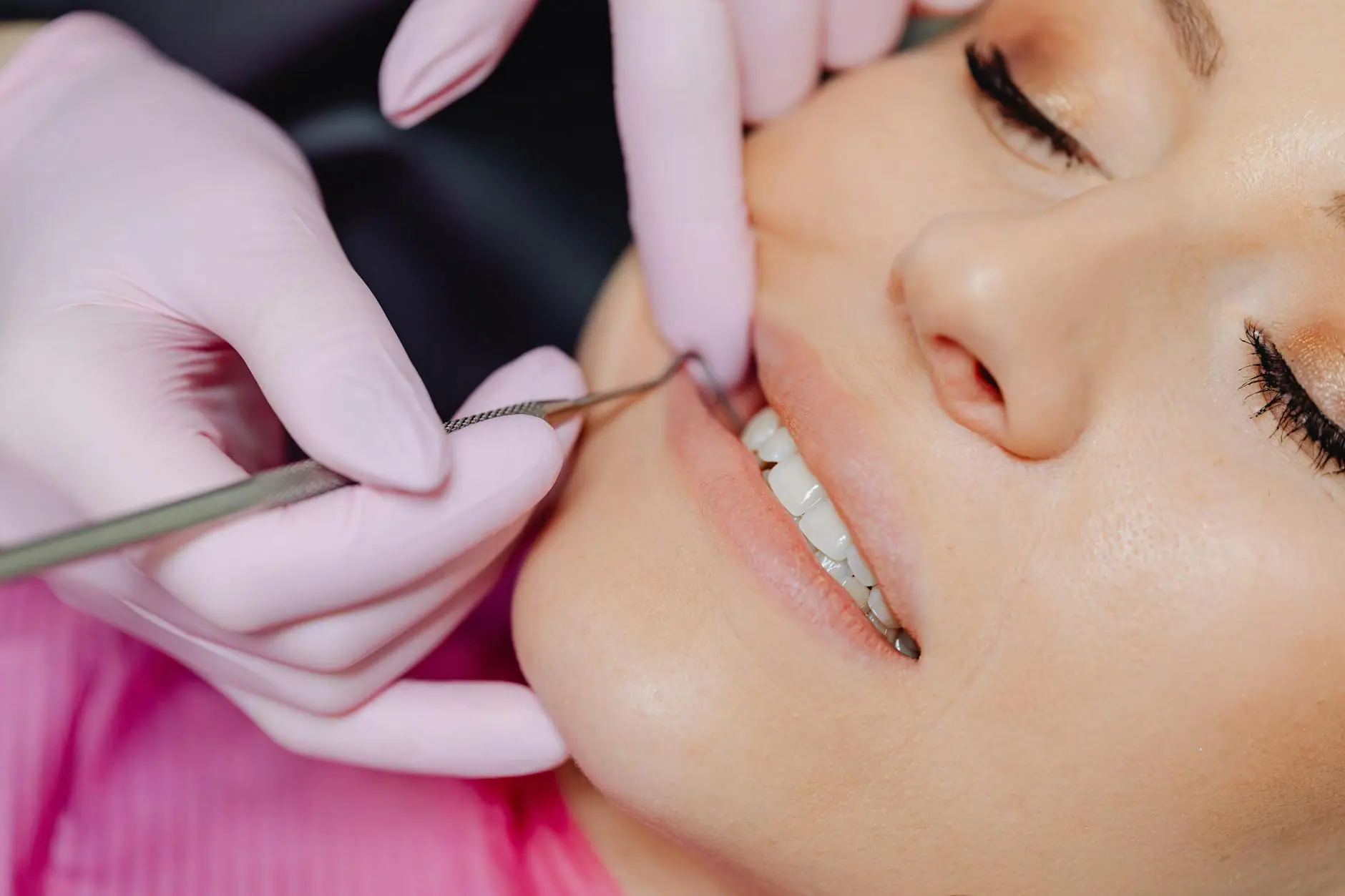 Blanqueamiento Dental en Medellín: Philips Zoom, Precios y Cuidados