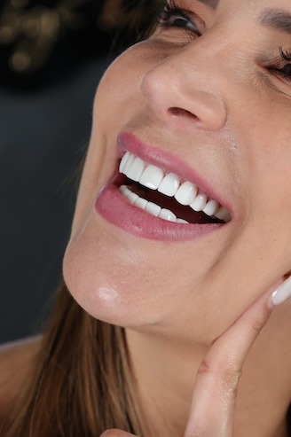 Porcelain Veneers