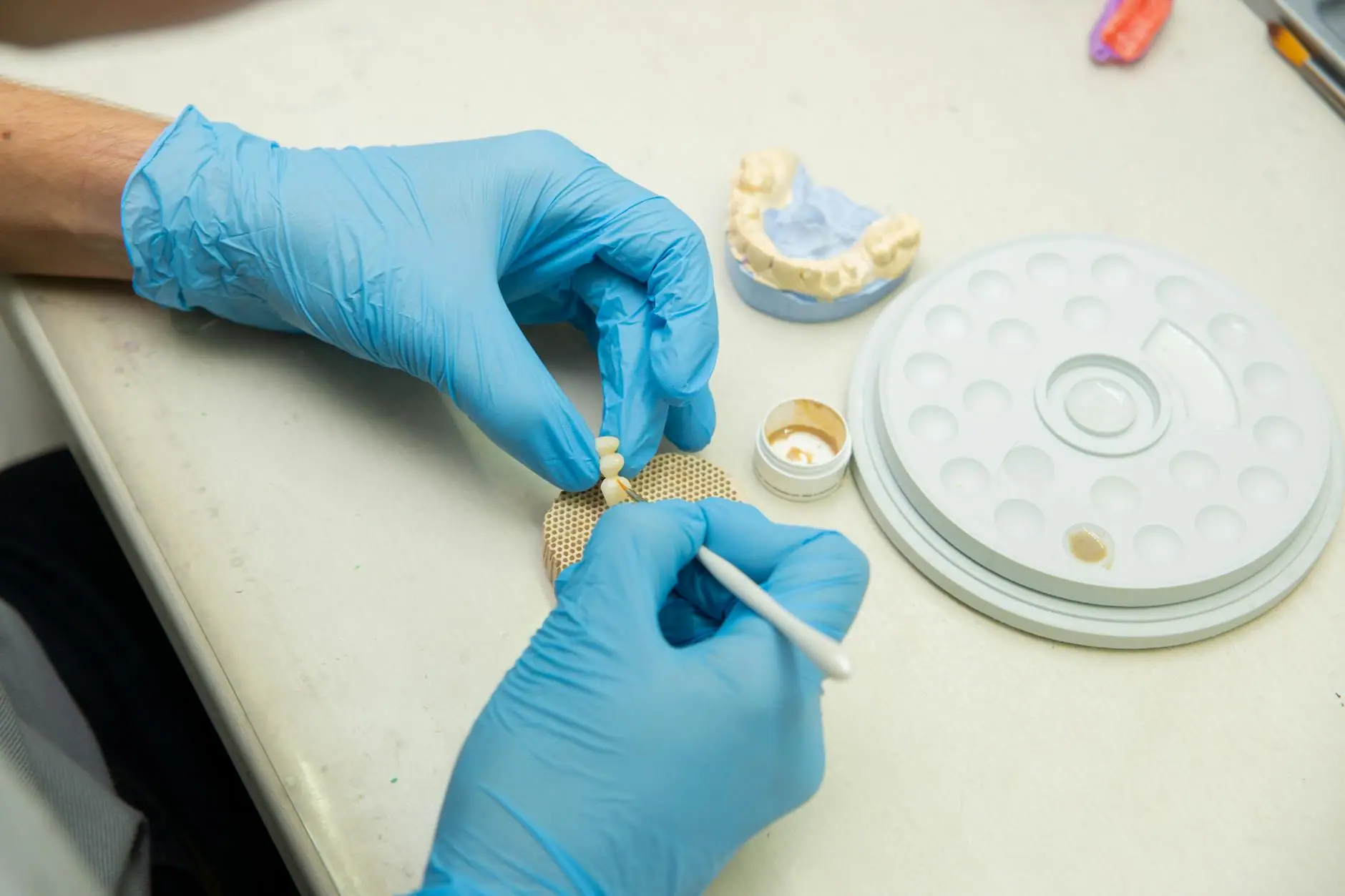 All-on-4 Implants